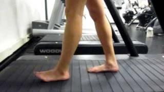 Gait Analysis walking barefoot on treadmill [upl. by Ennasirk]