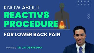 ReActiv8 Procedure for Lower Back Pain in Kansas City  Explained by Dr Jacob Kneeman [upl. by Neelra131]