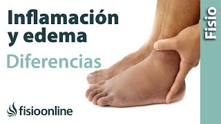 Inflamación y edema  Diferencias y características [upl. by Gladys80]