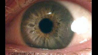 Eye Works 1 Focusing Cornea Iris and Lens [upl. by Niroc866]