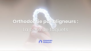 Orthodontie invisible par aligneurs  la pose de taquets [upl. by Drummond]