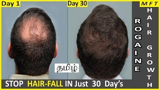 Rogaine Minoxidil for Hair Regrowth in 30 days  Where to buy Rogaine in India  Mens Fashion Tamil [upl. by Dicky281]