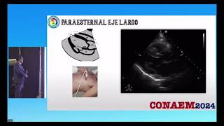 Ecocardiografia en urgencias Dr Jorge Marquez [upl. by Zzaj]