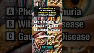 General knowledge about Rare diseasesshortsquiz [upl. by Dnalhsa]