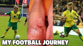 Becoming A Professional Footballer  ACL Surgery Being Released amp Academy Truth My Pro Journey [upl. by Booth37]