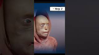 Face Transplant Surgery Animated Explanation [upl. by Ailemac]