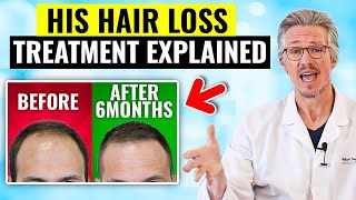 MUST SEE HAIR LOSS TURNAROUND IN JUST 6 MONTHS HOW MENS HAIR LOSS TREATMENT EXPLAINED [upl. by Aihsoem]