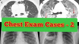 Radiology Viva Cases  144148  Chest Exam Cases Part 2 medical radiology ultrasound doppler [upl. by Aettam]