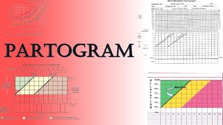 Partogram  Labour Monitoring and Assessment of Fetal WellBeing  TOACS amp OSCE Station [upl. by Em491]