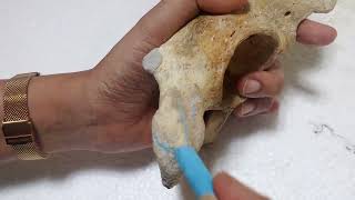 Ischial tuberosity of hip bone [upl. by Zsuedat313]