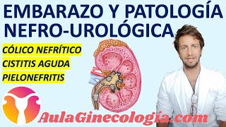 EMBARAZO Y PATOLOGÍA UROLÓGICA CÓLICO CISTITIS PIELONEFRITIS  Ginecología y Obstetricia [upl. by Valenza]