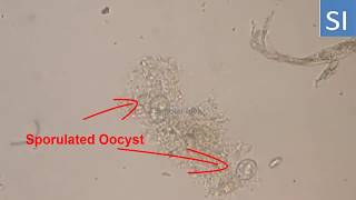 Sporulated oocyst of Coccidia [upl. by Aisinoid]