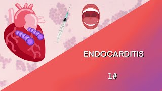 ENDOCARDITIS INFECCIOSA  parte 1 FISIOPATOLOGIA FACTORES DE RIESGO PATOGENOS y CLASIFICACION [upl. by Atalanta]