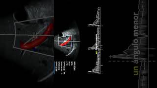 DOPPLER ARTERIA HEPÁTICA FÁCIL medicina doctor radiologia salud pocus gastro hígado [upl. by Magel]