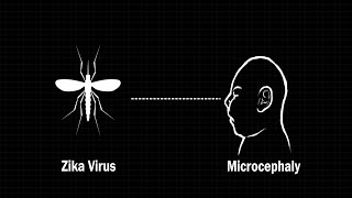 How the Zika virus affects an infants brain [upl. by Benedetto772]