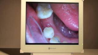 AG Neovo MedicalGrade Dental Display DR17 [upl. by Wende]