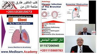 Bronchiectasis cme internalmedicine medical usmle محاضراتباطنة [upl. by Bollinger]