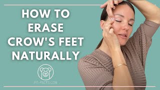 How to get rid of Crows feet Naturally [upl. by Mathew]