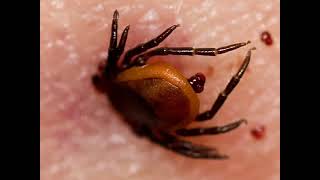 Tick  Ixodes scapularis マダニ [upl. by Rigby]