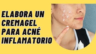 Cremagel antiacné con clindamicina e indometacina [upl. by Zsazsa]