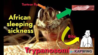 Trypanosomiasis I African sleeping sickness I Trypanosoma brucei gambiense amp rhodesiense I [upl. by Mullen584]