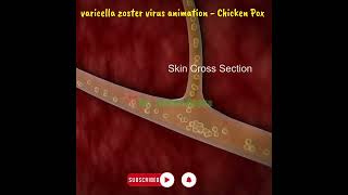 varicella zoster virus animation  What Causes Chickenpox Best Learning Videos For Kids shorts [upl. by Raynata]