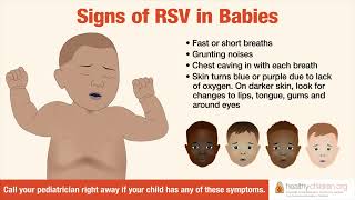 Signs amp Symptoms of RSV in Babies  AAP [upl. by Emmerie]