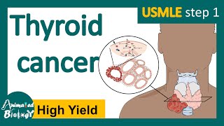 Most common thyroid cancer  Papillary thyroid carcinoma symptoms treatment and prognosis [upl. by Gib935]