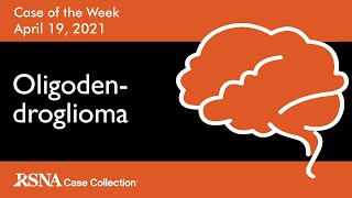 Case of the Week Oligodendroglioma [upl. by Uel106]