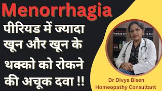 Menorrhagia Menorrhagia treatment Menorrhagia homoeopathy treatment heavy bleeding during periods [upl. by Ydasahc]