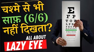 What is A LAZY EYE Amblyopia and How to Fix it  Amblyopia Lazy Eye Causes amp Treatment in Hindi [upl. by Amliw]