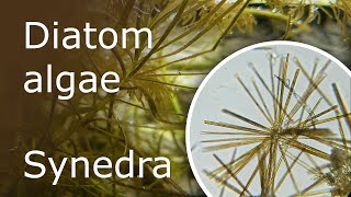 All About Diatom Algae Synedra in the Aquarium Description Causes and How to Get Rid of It [upl. by Alyekahs]