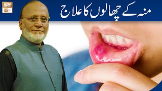 Mun Ke Chalon Ka Ilaj  Mouth Ulcers Remedy  Hakeem Abdul Basit [upl. by Nelyk217]