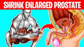 Top 4 Best Exercises for Your Enlarged Prostate [upl. by Walliw656]