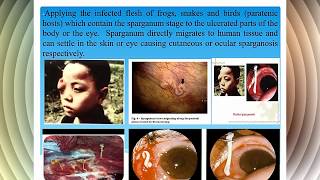 4Cestodes vet  DiphyllothriumTaenia [upl. by Raamal]