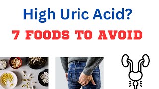 TOP 10 FOODS THAT REDUCE YOUR URIC ACID LEVELS [upl. by Banerjee]