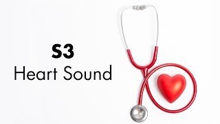 S3 Heart Sound  MEDZCOOL [upl. by Nangatrad]