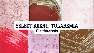 Morphology Moments  Tularemia [upl. by Vernita]