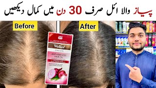 Wellice Anti Hair Loss Onion Hair Oil For Hair Growth amp Stope Hair Fall [upl. by Maje]