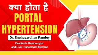 What is the Portal Hypertension Causes Symptoms amp Treatment explained by Dr Snehavarndhan Pandey [upl. by Chan879]