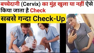 बच्चेदानी Cervix का मुंह खुला या नहीं ऐसे किया जाता है Check  Doctor Checks Cervix in Pregnancy [upl. by Jeromy]