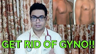 Doctor explains How to get rid of chest fat gynecomastia permanently  HINDI [upl. by Ronyar]