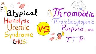 Atypical Hemolytic Uremic Syndrome aHUS vs Thrombotic Thrombocytopenic Purpura TTP [upl. by Mmada]