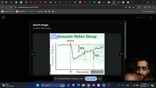 Otolaryngology ENT Audiology Acoustic reflex decay [upl. by Dian]