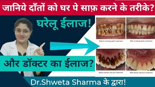 How To Remove Plaque And Tartar From Teeth At Home Naturally🦷How To Clean Teeth At Home in Hindi [upl. by Dibb]