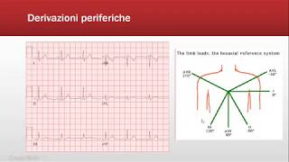 ECG Base Introduzione FOAMed [upl. by Sueaddaht]