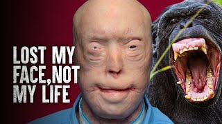 How I Survived a Chimpanzee Attack [upl. by Monte]