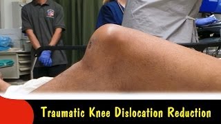 Traumatic Knee Dislocation ReductionQuick Version [upl. by Kurman]