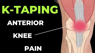 How to apply Kinesiology Tape for Anterior Knee  Patella tendonitis amp Patella femoral pain [upl. by Melessa]