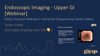 GIEQs Decision Making in Colorectal Polypectomy Taster video [upl. by Ipoillak]